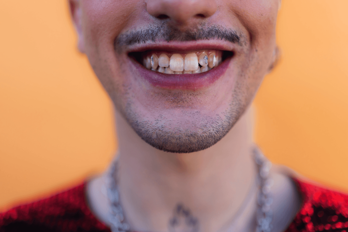 Are tooth gems haram?